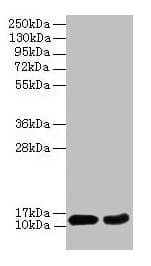 IHC-plus™ 4E-BP2 / EIF4EBP2 Antibody