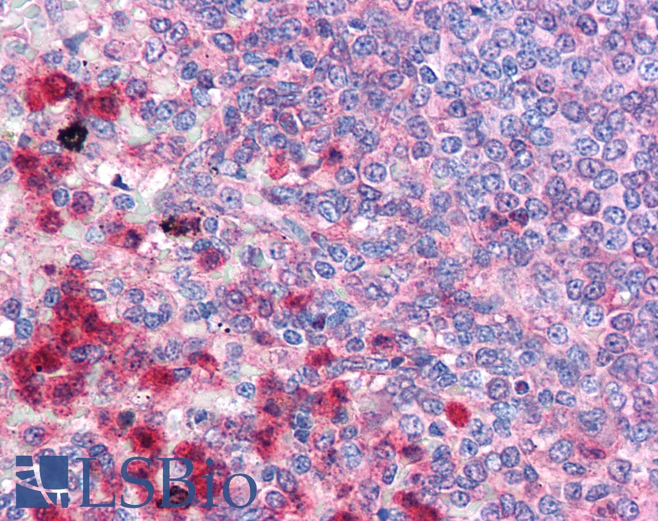 IHC-plus™ TRAF6 Antibody (C-Terminus)