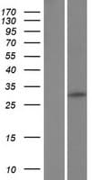 C12orf71 Protein (Over-Expression Lysate Myc-DDK (Flag))