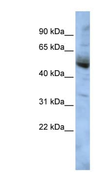 COPS4 / CSN4 Antibody (aa143-192)