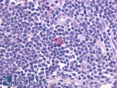 IHC-plus™ CXCR5 Antibody (Cytoplasmic Domain)