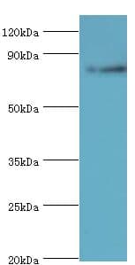 Polyclonal Rabbit anti-Human ARNT2 Antibody (aa440-690, IHC, WB)