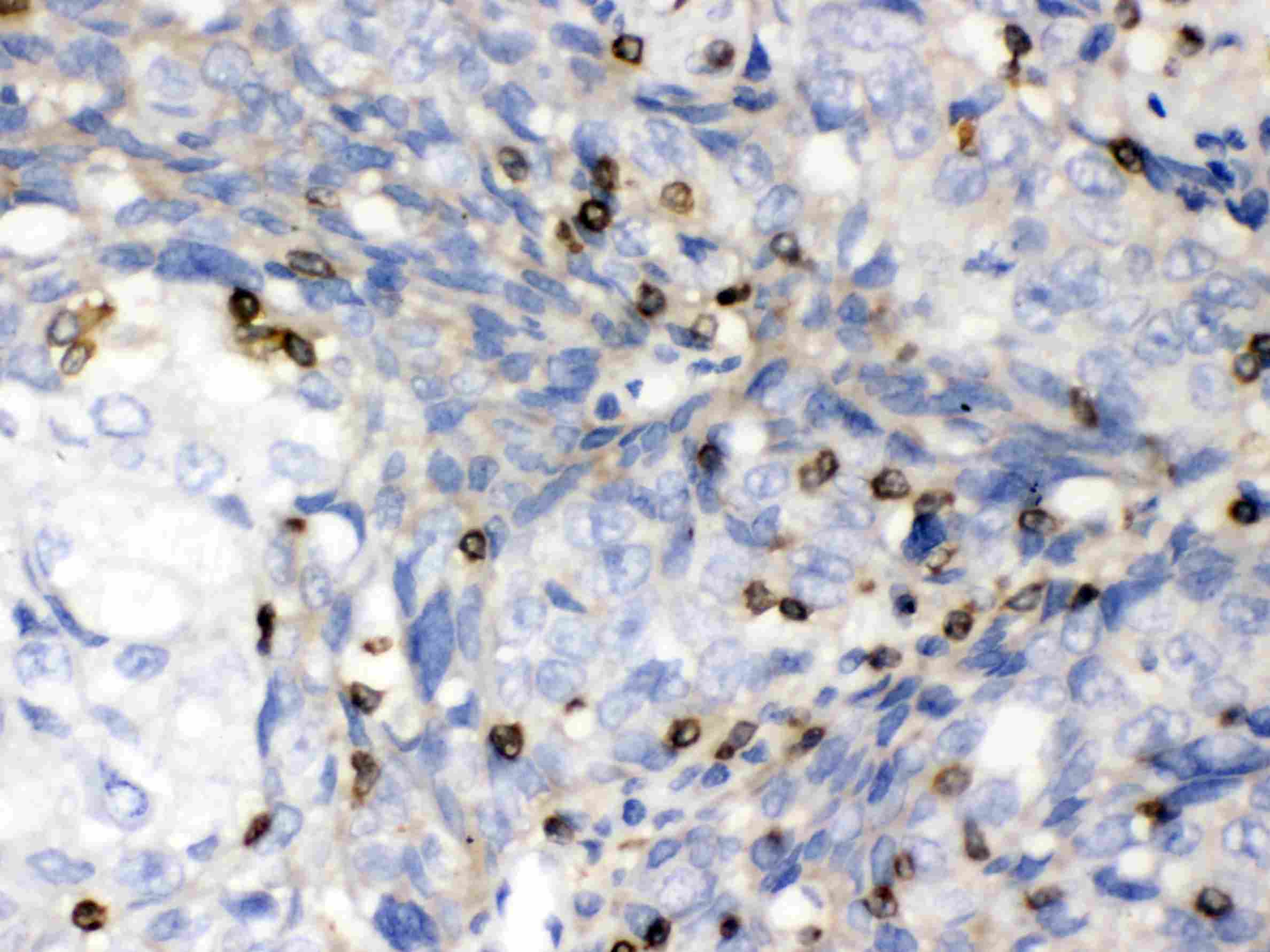 ABL2 Antibody