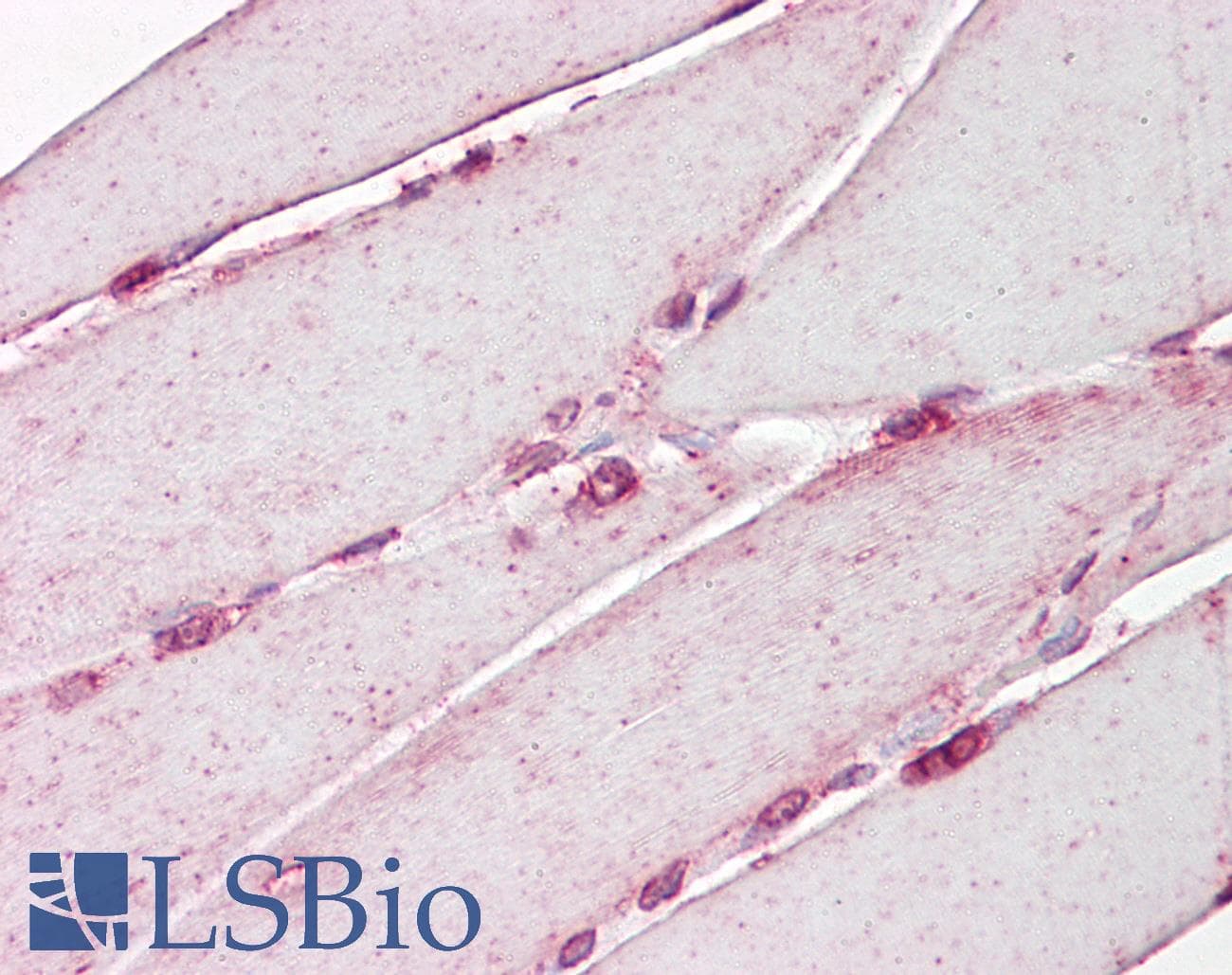 IHC-plus™ Polyclonal Rabbit anti-Human LMNA / Lamin A+C Antibody (aa212-261, IHC, WB)