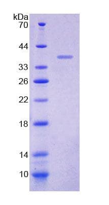 Human MYOM2 / Myomesin 2 Protein (Recombinant His-T7)
