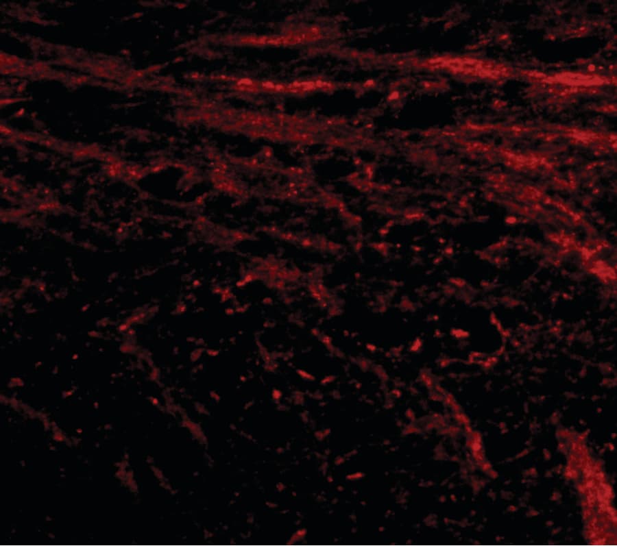 IL16 Antibody