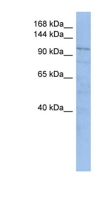 TRAK1 Antibody (aa467-516)
