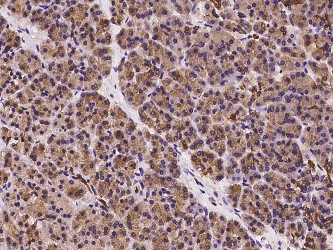 NAG20 / UBAP1 Antibody