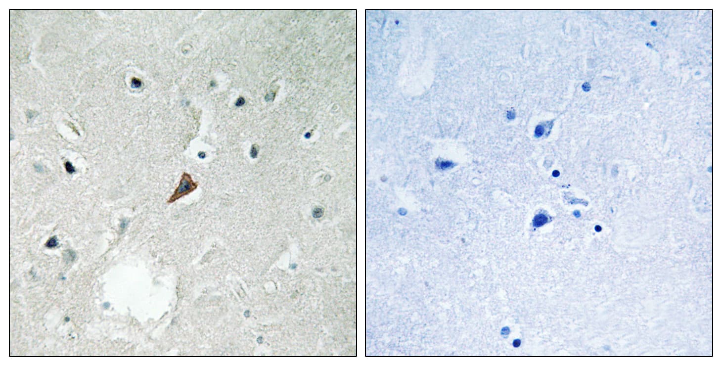 PTK2B / PYK2 Antibody (phospho-Tyr579)