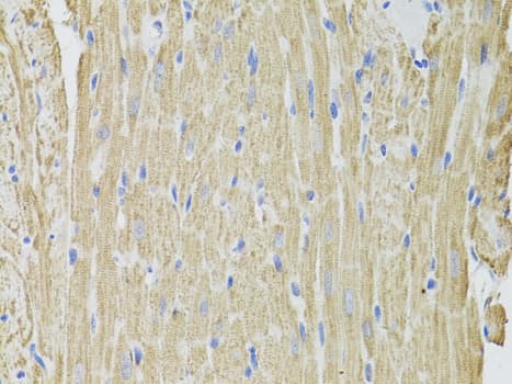 Polyclonal Rabbit anti-Human FHIT Antibody (IHC, WB)