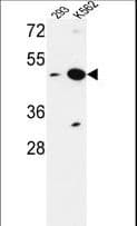 NUPL2 Antibody (aa88-115)