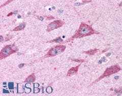 PathPlus™ CELSR2 Antibody (N-Terminus)