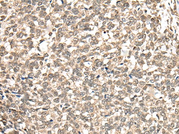 PHF21A / BHC80 Antibody