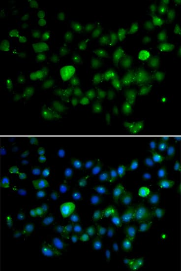 MCM10 Antibody