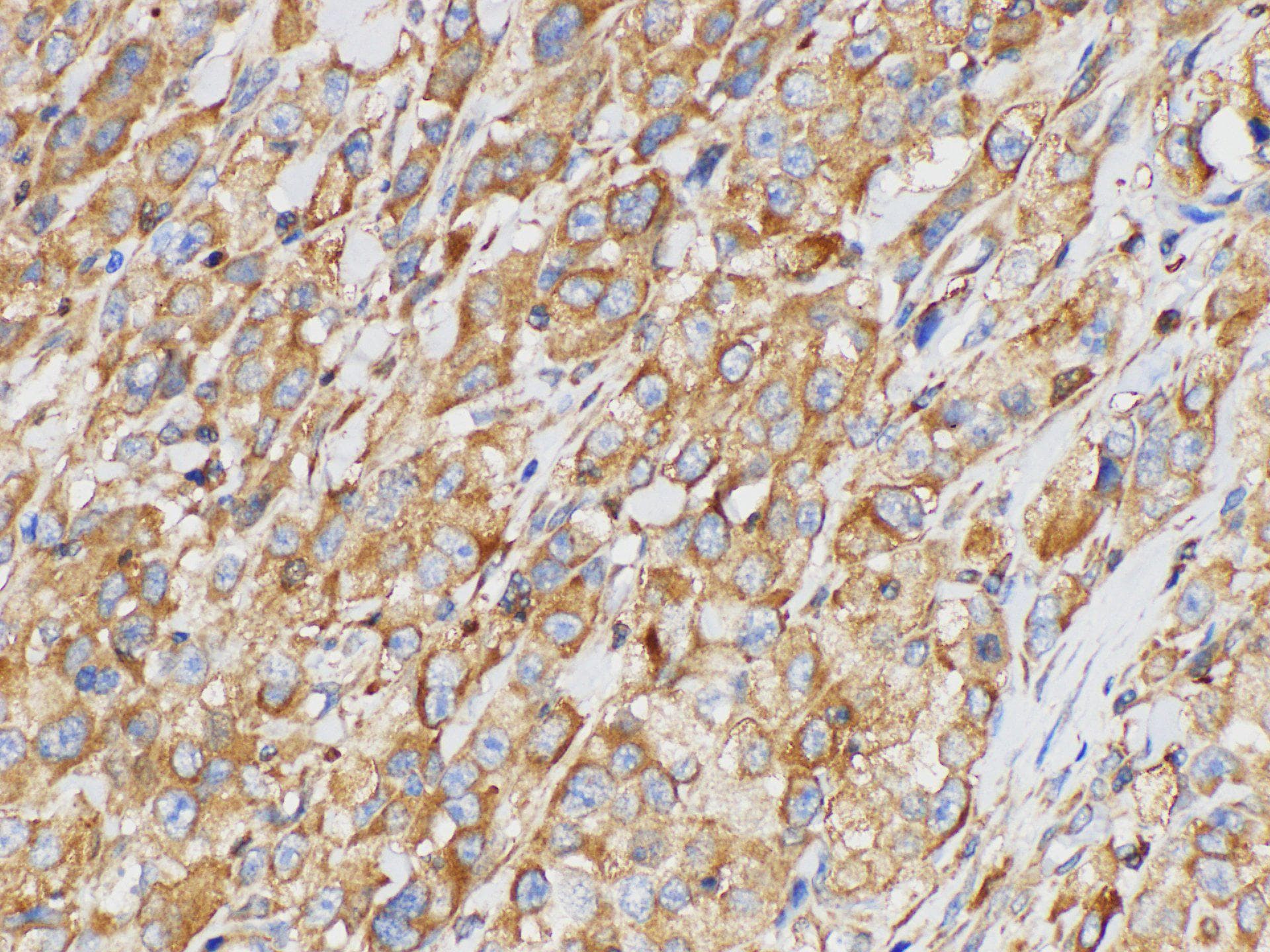 SERPINB2 / PAI-2 Antibody
