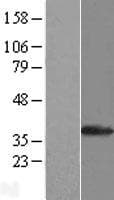 SULT1A1 / Sulfotransferase 1A1 Protein (Over-Expression Lysate Myc-DDK (Flag))