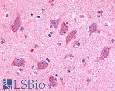 PathPlus™ ADGRB2 / BAI2 Antibody (N-Terminus)