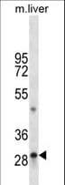 TPSAB1 / Mast Cell Tryptase Antibody (aa249-275)