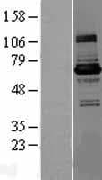Human KLHL22 Protein (Over-Expression Lysate Myc-DDK (Flag))