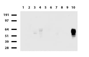 Monoclonal Mouse anti-Human CD2 Antibody (clone UMAB86, Carrier-free, IHC, IF, WB)