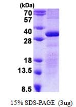 Human SGCD / Delta-Sarcoglycan Protein (Recombinant His)