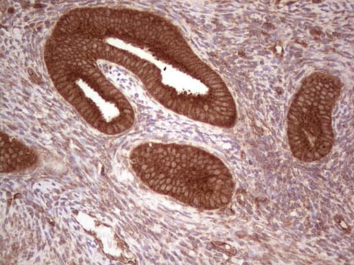 UBE2D2 / UBCH5B Antibody (clone OTI2C2)