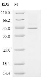 Human ZP3 Protein (Recombinant 6His, N-terminus)
