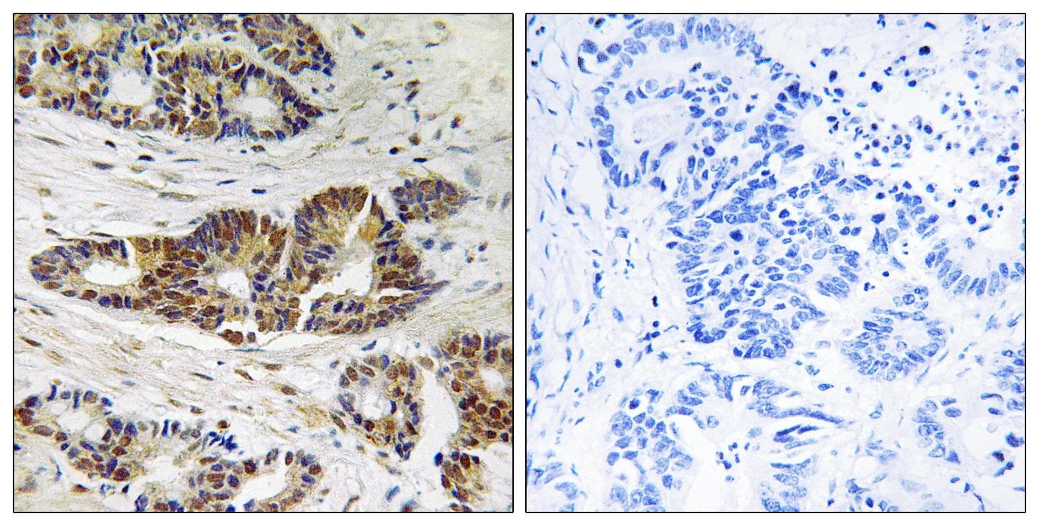 Polyclonal Rabbit anti-Human ADRBK1 / GRK2 Antibody (Ab-685, IHC, WB)