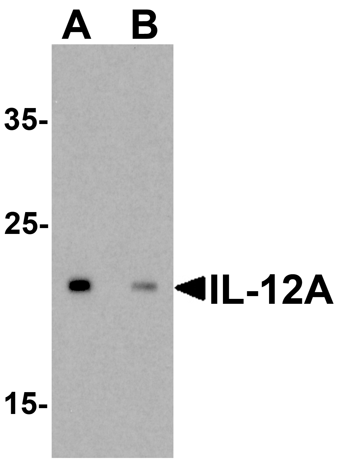 IHC-plus™ IL12A / p35 Antibody