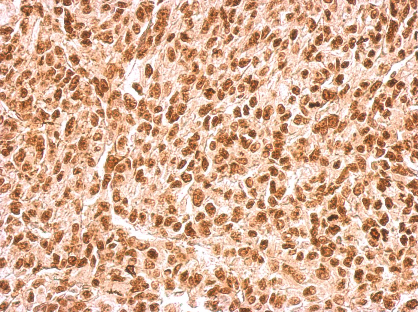 APEX1 / APE1 Antibody (aa1-45)