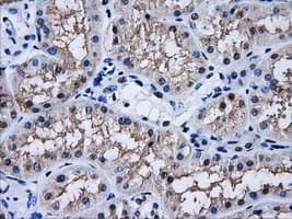 AKR1A1 Antibody (clone OTI8E12)