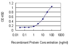 Monoclonal Mouse anti-Human DMD / Dystrophin Antibody (clone 3A11, WB)