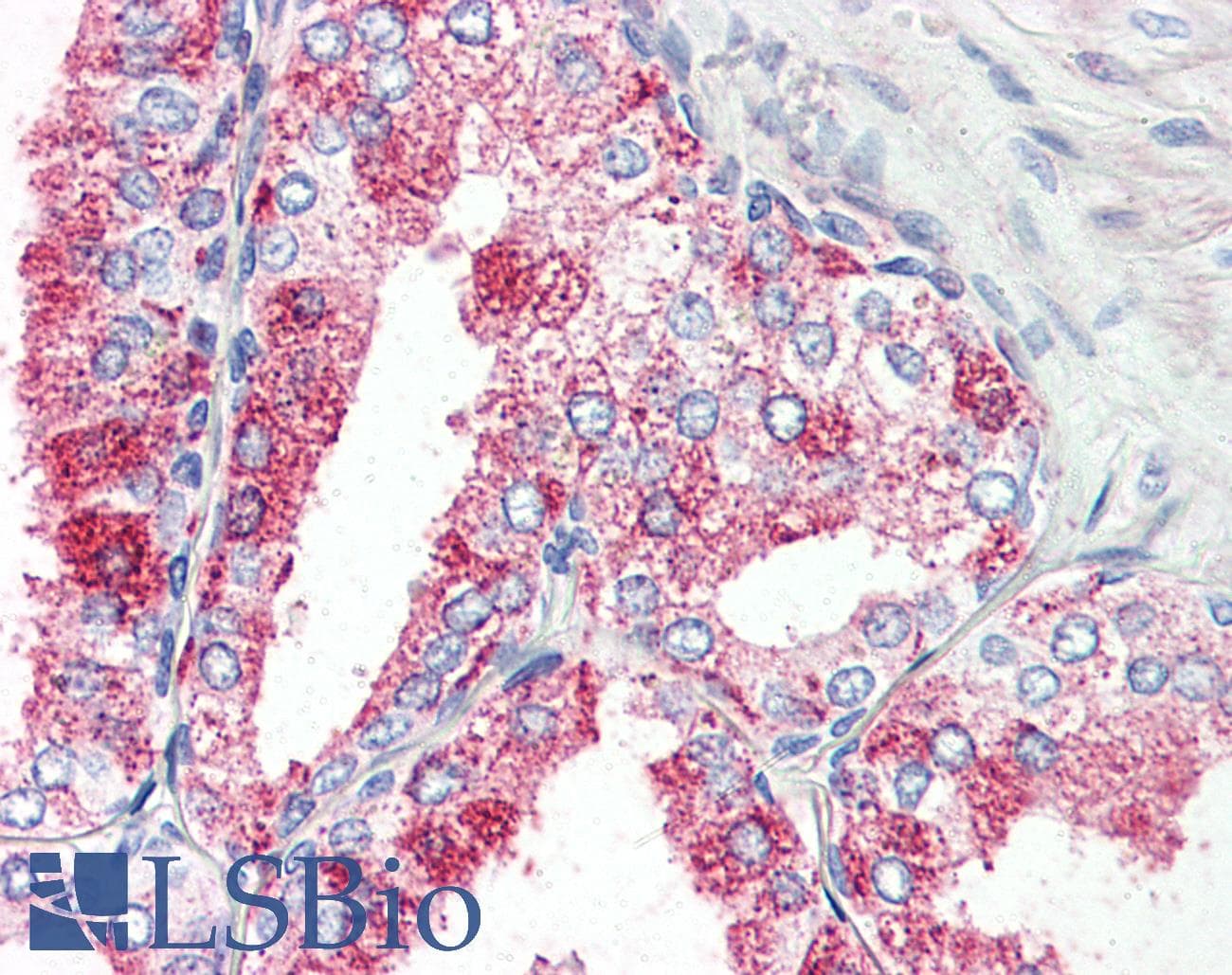 IHC-plus™ Polyclonal Rabbit anti-Human GPR27 Antibody (Internal, IHC)