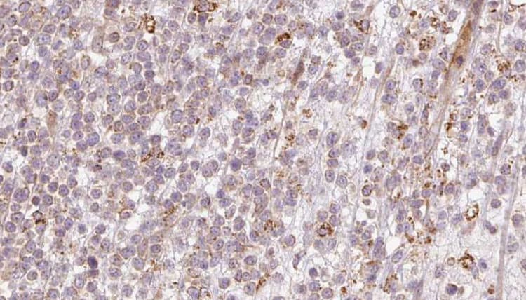 Polyclonal Rabbit anti-Human CALCOCO2 Antibody (IHC, IF, WB)