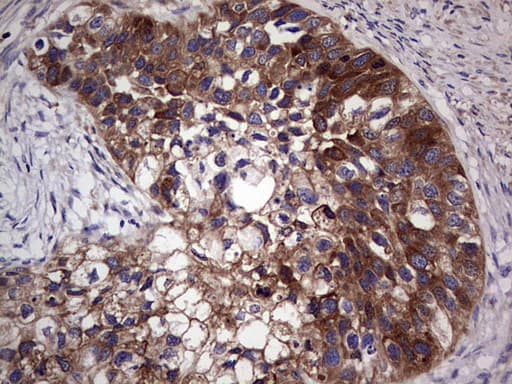 GARS / Glycyl tRNA Synthetase Antibody (clone OTI6C5)