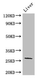 GJB2 / CX26 / Connexin 26 Antibody