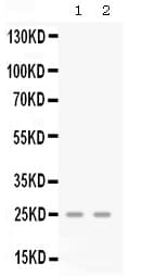 CXCL3 / GRO Gamma Antibody