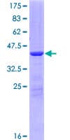 Human LSM4 Protein (Recombinant GST)