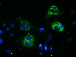 Paraplegin / SPG7 Antibody (aa300-573, clone OTI7D10, Carrier-free)