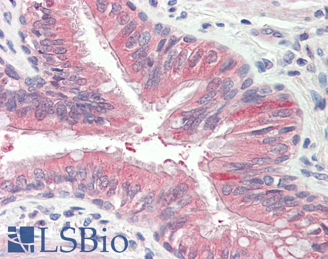 IHC-plus™ EPS8L2 Antibody (aa1-50)