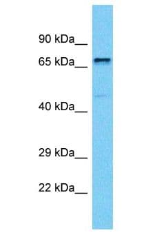 PAPD5 Antibody (aa649-698)