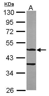 Polyclonal Rabbit anti-Human ASB4 Antibody (aa29-357, IHC, WB)