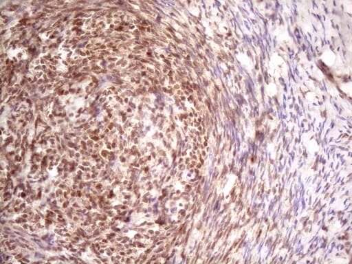 PRPK / TP53RK Antibody (clone OTI5A5)