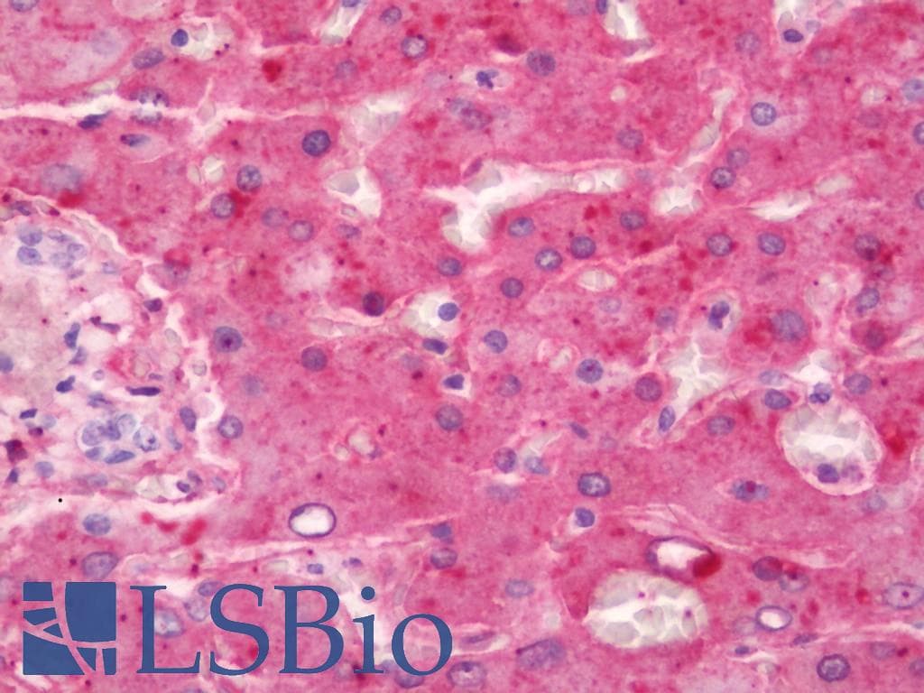 IHC-plus™ APOB / Apolipoprotein B Antibody (clone GF1)