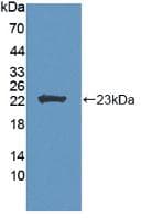 LCAT Antibody (aa41-210)