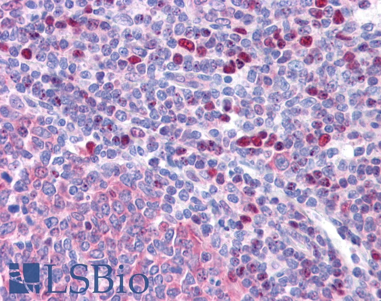 IHC-plus™ VENTX Antibody