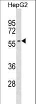 SMPD3 / NSMASE2 Antibody (aa137-165)