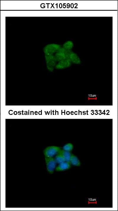 SUOX / Sulfite Oxidase Antibody (aa1-291)