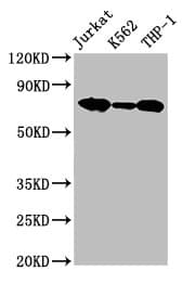 Polyclonal Rabbit anti-Human LCP1 / L-Plastin Antibody (aa2-627, IHC, WB)