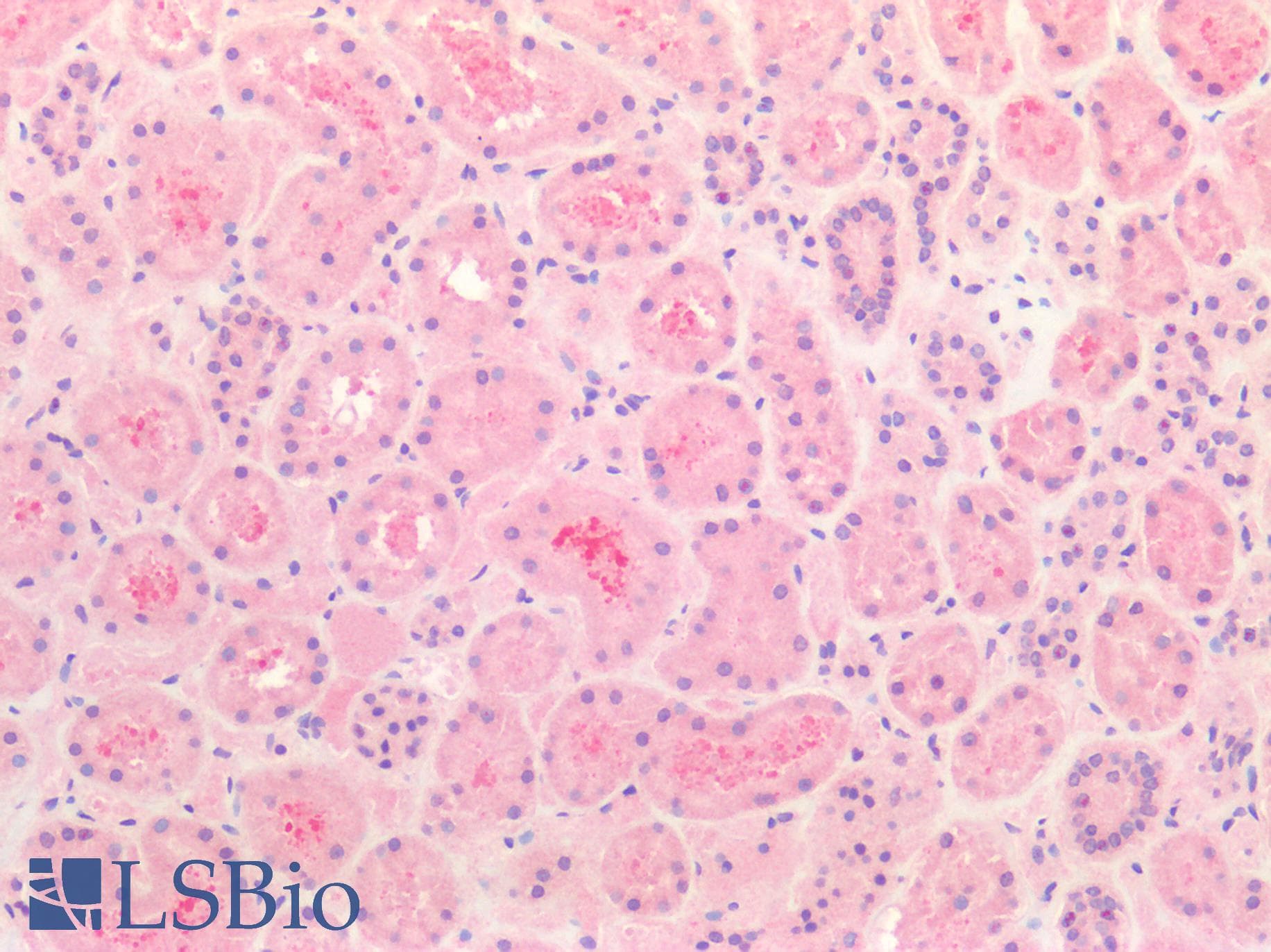 IHC-plus™ Polyclonal Rabbit anti-Human HGF / Hepatocyte Growth Factor Antibody (IHC)